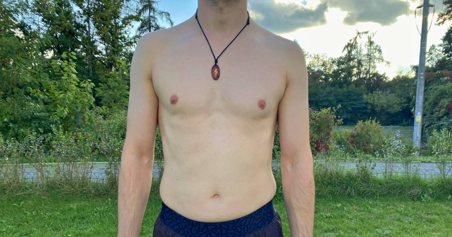 Bolesti zad a páteře – pomůže posilování středu těla neboli „core“?